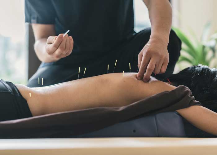 Acupressure